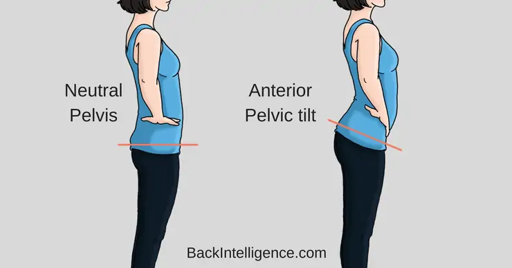 neutral pelvis anterior tilt low back pain physical therapy pt corner lyt yoga online classes