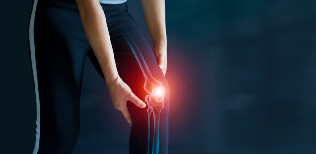 Knee Osteoarthritis