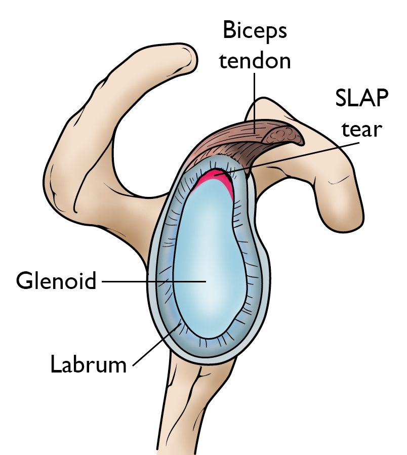 Shoulder Labral